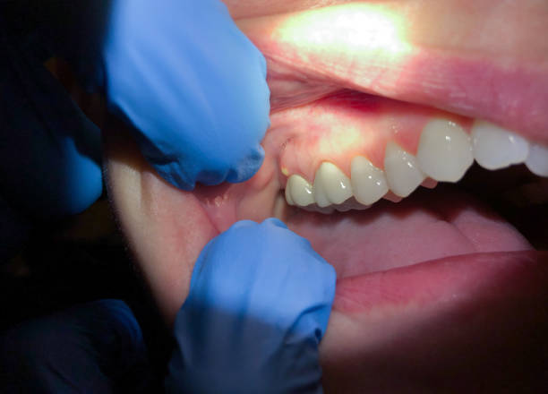 Urgent Tooth Repair in TN