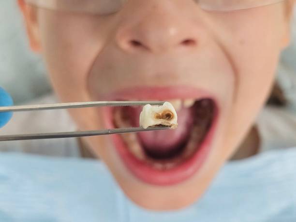 Best Tooth Pain Emergency Relief  in Mcminnville, TN